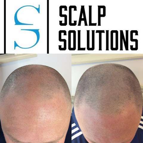 Scalp Solutions photo